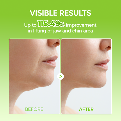 Dr.Melaxin CACTOX V-Lifting Mewing Band – Cactox + Caffeine + Collagen Double Chin Lifting Band for Sagging Jawline & Facial Puffiness | 115.49% Jaw & Chin Lifting Improvement | Korean V-Line Lifting